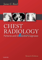 Chest Radiology Patterns And Differential Diagnoses 7Th Edition