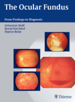 The Ocular Fundus From Findings To Diagnosis