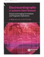 Electrocardiography İn Ischemic