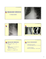 Foreign Body Oesophagus And Bronchus