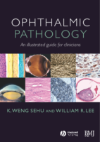 Ophthalmic Pathology An Illustrated Guide For Clinicians