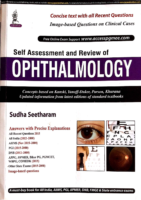 Self Assessment And Review Of Ophthalmology (1)