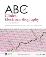 Abc Of Clinical Electrocardiography 2Nd Ed