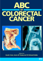 Abc Of Colorectal Cancer