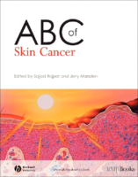 Abc Of Skin Cancer