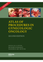 Douglas Atlas Of Procedures İn Gynecologic Oncology
