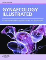 Gynaecology İllustrated 6Th Ed (2011)