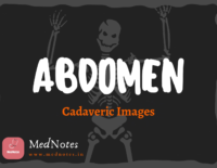 Abdominal Wall Peritoneum [Free Version]