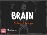 Brain Cadaveric Images [Free Version]