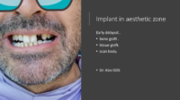 Implant in aesthetic zone