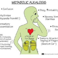 Metabolic Alkalosis Flashcard