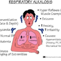 Respiratory Alkalosis Flashcard