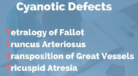 Cyanotic Defects – Lecture Notes Mnemonic Coded Word