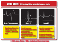 Dead Beats – ECG Beats With The Potential To Cause Death