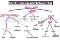ECG İnterpretation Flowchart