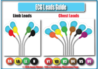 ECG Leads Guide – Limb Leads And Chest Leads