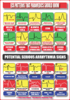 ECG Patterns That Paramedics Should Know – Cardiac Nursing Notes