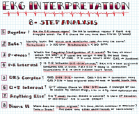 EKG İnterpretation – 8 Step Analysis