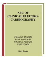 Ecg Abc Of Clinical Electrocardiography
