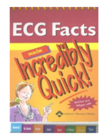 Ecg Facts Made Incredibly Quick