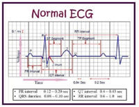 How İs İt Looks The Normal ECG – Normal ECG Result