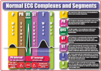Normal ECG Complexes And Segments – Cardiac Nursing Notes