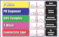 P Wave PR Segment QRS Complex T Wave İsoelectric Line