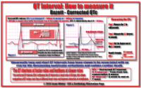 QT İnterval How To Measure İt – Bazed Corrected QTc