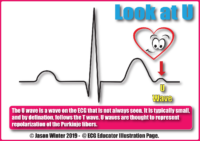 U Wave – Cardiac Nursing Notes