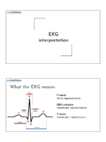 Ekgs interpretation